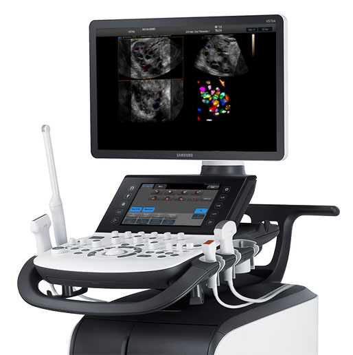 samsung-hs70a-with-prime-ultrasound-machine
